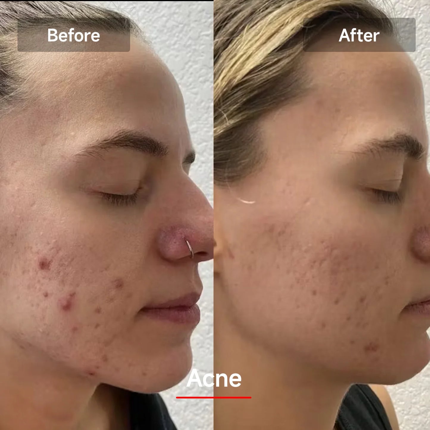 Red Light Therapy Face Mask